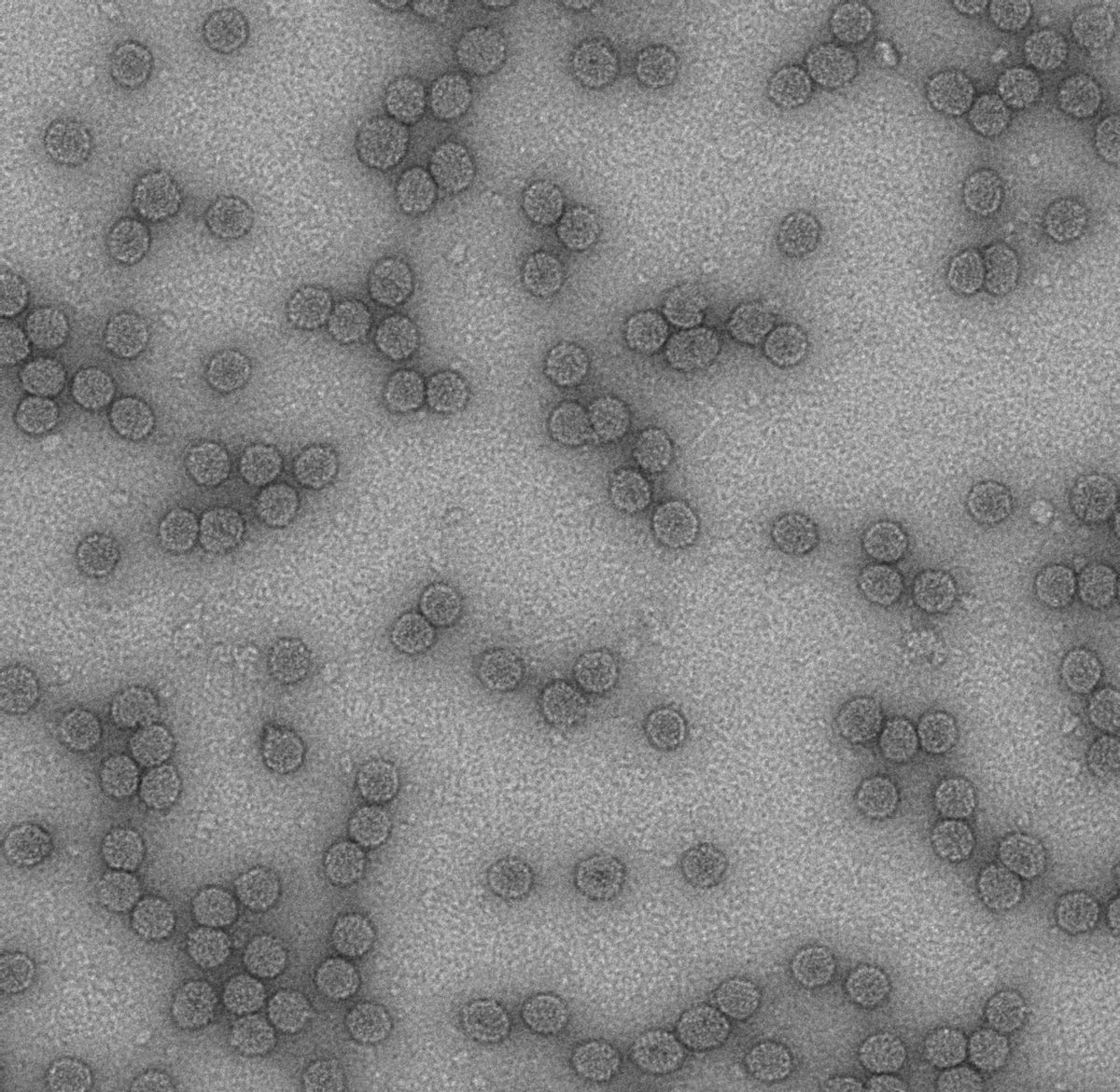 TEM image of nanoparticles that differ from the background only by texture