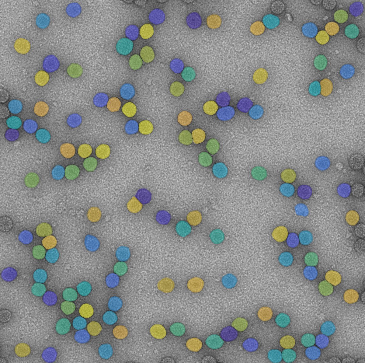 The same image with every nanoparticle detected by Spotlight and coloured by size